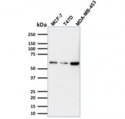 p63 Antibody for WB. Western blot analysis of human MCF-7, T-47D, and MDA-MB-453 cell lysates using mouse monoclonal clone TP63/1786 demonstrates detection of Tumor protein 63 (TP63) as a band at the predicted molecular weight of approximately 63-77 kDa. Signal intensity varies across the cell lines, with stronger expression observed in MDA-MB-453 cells and comparatively lower levels in MCF-7 and T-47D, consistent with differences in TP63 expression associated with epithelial subtype characteristics. The clean banding pattern with minimal background supports the specificity of clone TP63/1786, aligning with its microarray-validated target recognition and suitability for western blot detection of TP63 isoforms.