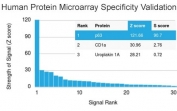 p63 Antibody for WB protein microarray specificity validation using a HuProt(TM) array containing more than 19,000 full-length human proteins demonstrates highly selective binding of mouse monoclonal clone TP63/1786 to Tumor protein 63 (TP63). The antibody shows a dominant top-ranked signal for TP63 with a markedly elevated Z-score compared to all other proteins on the array, indicating strong and specific target recognition. Minimal signal is observed for non-target proteins, supporting low off-target binding and high analytical specificity. Z-score reflects signal intensity relative to the array mean, while S-score represents the separation between the top-ranked target and subsequent proteins, confirming clear discrimination of TP63 from other candidates. These results support the suitability of clone TP63/1786 for western blot applications requiring high specificity and clean band interpretation.