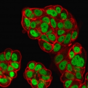 FOXA1 Antibody MCF7 Cell IF. Immunofluorescent staining of PFA-fixed human MCF7 cells using FOXA1 Antibody (clone FOXA1/1519) demonstrates strong green nuclear staining consistent with localization of FOXA1, a forkhead family transcription factor that regulates developmental gene expression, epithelial differentiation, and tissue-specific transcriptional programs. The predominantly nuclear staining pattern is characteristic of a DNA-binding transcriptional regulator and supports the role of FOXA1 in controlling gene networks that govern cellular identity, lineage specification, and differentiated epithelial phenotypes. Phalloidin (red) labels the actin cytoskeleton and outlines cellular morphology, providing structural contrast to the nuclear localization of FOXA1.
