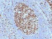 MCM7 Antibody Human Tonsil IHC. Immunohistochemistry testing of FFPE human tonsil with MCM7 antibody (clone SPM379). Required HIER: boil tissue sections in pH 9 10mM Tris with 1mM EDTA for 10-20 min.