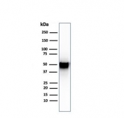 Thymidine Phosphorylase Antibody Human Spleen WB. Western blot testing of human spleen lysate with Thymidine Phosphorylase antibody (clone SPM322). Predicted molecular weight ~55 kDa.