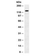 Western blot testing of human brain lysate with N-Cadherin antibody. Predicted molecular weight ~100 kDa (unmodified), 125-140 kDa (modified).