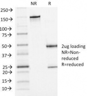 P-Cadherin Antibody Clone 6A9 Purity Gel Run. SDS-PAGE analysis of purified, BSA-free P-Cadherin Antibody Clone 6A9 / Mouse Monoclonal Antibody under non-reducing (NR) and reducing (R) conditions. A 2 ug sample was analyzed to confirm antibody integrity and purity. The non-reduced antibody migrates at approximately 150 kDa, while reduced conditions show expected heavy and light chain bands near 50 kDa and 25 kDa, respectively. These results demonstrate the purity of P-Cadherin Antibody Clone 6A9 / Mouse Monoclonal Antibody and support its use in antibody-based detection applications.