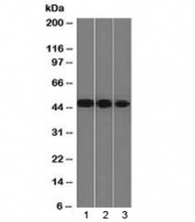 NSE Antibody human cell line western blot analysis. Western blot analysis of Neuron Specific Enolase in human cell lysates using NSE Antibody / Neuronal Differentiation Marker Antibody clone ENO2/1375 shows a band at approximately 47 kDa. Lane 1: human Y79 cell lysate, Lane 2: human HeLa cell lysate, Lane 3: human HepG2 cell lysate. A band is detected at approximately 47 kDa, consistent with the predicted molecular weight of Neuron Specific Enolase (ENO2). The observed band across multiple human cell lines supports expression of this neuronal differentiation marker in cells with varying degrees of neuronal or metabolic activity.