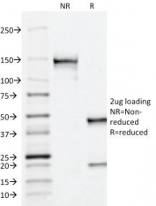 SDS-PAGE Analysis of Purified, BSA-Free Prostate Acid Phosphatase Antibody (ACPP/1338). Confirmation of Integrity and Purity of the Antibody.