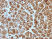 Elastase 3B Antibody Human Pancreas IHC. Immunohistochemistry analysis of FFPE human pancreas tissue stained with clone CELA3B/1257. Strong granular cytoplasmic HRP-DAB brown staining is observed throughout pancreatic acinar cell populations, consistent with expression of Chymotrypsin-like elastase family member 3B / CELA3B, a secreted digestive serine protease involved in exocrine pancreas function and digestive enzyme secretion pathways. Required HIER: boil tissue sections in 10mM Tris with 1mM EDTA, pH 9, for 10-20 min followed by cooling at RT for 20 min.