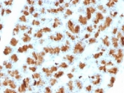 Elastase 3B Antibody Rat Pancreas IHC. Immunohistochemistry analysis of FFPE rat pancreas tissue stained with clone CELA3B/1257. Strong granular cytoplasmic HRP-DAB brown staining is observed within pancreatic acinar cell populations, consistent with expression of Chymotrypsin-like elastase family member 3B / CELA3B, a digestive serine protease involved in exocrine pancreatic secretion and digestive enzyme processing pathways. Required HIER: boil tissue sections in 10mM Tris with 1mM EDTA, pH 9, for 10-20 min followed by cooling at RT for 20 min.