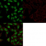 TOP2A Antibody HeLa IF. Immunofluorescence analysis of PFA-fixed human HeLa cells demonstrates strong nuclear staining of DNA Topoisomerase II alpha, a chromosome segregation enzyme that functions during mitosis to resolve DNA catenanes and enable sister chromatid separation. Green fluorescence highlights nuclear localization of the TOP2A protein in proliferating cells, consistent with its role in chromosome decatenation and mitotic chromosome segregation. Phalloidin staining (red) marks the actin cytoskeleton, outlining cell morphology and providing cytoplasmic reference while TOP2A signal remains predominantly nuclear. The Chromosome Segregation Enzyme Antibody enables visualization of the nuclear enzyme responsible for chromatid decatenation and proper chromosome partitioning during cell division in immunofluorescence assays.