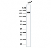 TOP2A Antibody HeLa WB. Western blot analysis of human HeLa cell lysate following SDS-PAGE separation and membrane transfer demonstrates detection of DNA Topoisomerase II alpha. A band is detected at approximately 170-180 kDa, consistent with the predicted molecular weight of DNA Topoisomerase II alpha / TOP2A (~174 kDa). The signal corresponds to the chromosome segregation enzyme responsible for resolving DNA catenanes and enabling sister chromatid separation during mitosis. Detection of the denatured TOP2A protein band confirms the utility of this Chromosome Segregation Enzyme Antibody for western blot analysis of this essential mitotic enzyme in human cell lysates.