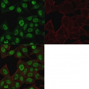 Topoisomerase II alpha Antibody for IF / TOP2A Immunofluorescence Antibody (clone TOP2A/1361). Immunofluorescence analysis of PFA-fixed human HeLa cells using the mouse monoclonal clone TOP2A/1361 demonstrates strong nuclear fluorescence consistent with the intracellular localization of Topoisomerase II alpha. Cells were stained with Topoisomerase II alpha antibody (green) to visualize nuclear TOP2A protein distribution, while Phalloidin (red) highlights the actin cytoskeleton and cell boundaries. The merged image shows clear nuclear immunofluorescence signal corresponding to proliferating cells, consistent with the known role of TOP2A as a DNA replication associated nuclear enzyme. The Topoisomerase II alpha Antibody for IF enables high resolution fluorescence microscopy detection of TOP2A protein and supports immunofluorescence studies examining nuclear protein localization, cell cycle progression, and proliferation associated chromatin dynamics.