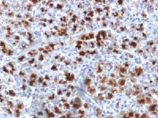Immunohistochemistry of CELA3B antibody (microarray validated clone CELA3B/1757) in human pancreas. Formalin-fixed, paraffin-embedded human pancreatic tissue demonstrates strong granular cytoplasmic staining in acinar cells, consistent with the secretory localization of Chymotrypsin-like elastase family member 3B, while surrounding stromal and ductal structures show minimal staining. Required HIER: boil tissue sections in 10mM Tris with 1mM EDTA, pH 9, for 10-20 min followed by cooling at RT for 20 min.