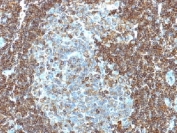 CD3e Antibody Clone PC3/188A. Immunohistochemistry analysis of CD3 Epsilon / CD3E antibody in human tonsil tissue using CD3e Antibody Clone PC3/188A / CD3 Epsilon Monoclonal Antibody. Strong HRP-DAB brown membranous and cytoplasmic staining is observed in T lymphocytes within interfollicular and paracortical regions, consistent with T-cell zone distribution, while surrounding non-lymphoid cells show minimal background. The staining highlights dense T-cell populations within lymphoid architecture and supports identification of CD3-positive immune cells in tissue sections. Heat-induced epitope retrieval was performed by boiling tissue sections in 10 mM citrate buffer, pH 6.0, for 10-20 minutes prior to staining.