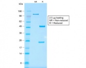 SDS-PAGE analysis of purified, BSA-free recombinant EpCAM antibody (clone rMOC-31) as confirmation of integrity and purity.