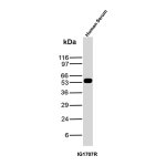 Human IgG Antibody IG1707R Human Serum WB. Western blot analysis was performed using Human IgG Antibody IG1707R on human serum lysate. A distinct immunoreactive band is detected at approximately 50â55 kDa, consistent with the expected molecular weight of the human IgG heavy chain. The blot exhibits a strong, specific signal with minimal background, supporting reliable detection of endogenous human IgG in serum samples. These results demonstrate that Human IgG Antibody IG1707R is suitable for Western blot detection of human IgG in serum.