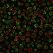 Immunofluorescence analysis of CD79a / Ig-alpha antibody (clone IGA/1688R) in PFA-fixed human Raji cells. CD79a antibody staining (green) demonstrates predominantly cytoplasmic and membranous fluorescence consistent with B cell receptor complex localization. Reddot nuclear stain (red) highlights cell nuclei. The staining pattern aligns with expected CD79a expression in B lymphocyte-derived Raji cells.