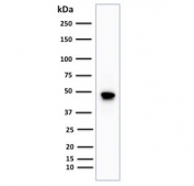 Western blot testing of human Raji cell lysate with CD79a antibody (clone IGA/1688R). Expected molecular weight: 25-47 kDa depending on glycosylation level.