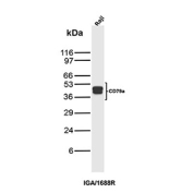 Western blot analysis of CD79a / Ig-alpha antibody (clone IGA/1688R) in human Raji cell lysate. A clear doublet is detected at approximately 45-50 kDa, consistent with the predicted molecular weight range for CD79a and its commonly observed apparent migration on SDS-PAGE. The presence of two closely spaced bands is compatible with CD79a heterogeneity, such as differential N-linked glycosylation and or isoform processing, which can produce a doublet pattern in B cell lysates.