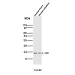 CD81 Antibody 1.3.3.22 Human Heart and Intestine WB. Western blot analysis of human heart and intestine tissue lysates using CD81 Antibody, clone 1.3.3.22. A specific band is detected at approximately 22-24 kDa, consistent with the expected molecular weight of CD81. This CD81 Antibody 1.3.3.22, also called a Tetraspanin-28 Antibody, detects CD81 in human heart and intestine tissues and supports studies of tetraspanin expression, membrane organization and cell signaling.