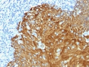 Pan Cytokeratin Antibody human skin IHC. Immunohistochemistry analysis of cytokeratin expression in FFPE human skin using Pan Cytokeratin antibody. Strong cytoplasmic HRP-DAB brown staining highlights continuous epithelial layers within the epidermis, clearly outlining keratinocyte cohesion and tissue integrity, while underlying dermal structures remain largely negative. The staining pattern supports evaluation of epithelial barrier structure and cellular organization. HIER was performed using 10 mM citrate buffer, pH 6, for 10â20 minutes followed by cooling at room temperature prior to antibody incubation.