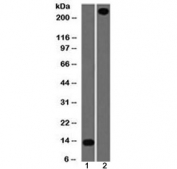 vWF Antibody Clone VWF/1859R western blot analysis. Western blot of 1) partial recombinant protein and 2) human lung lysate using vWF Antibody Clone VWF/1859R (clone VWF/1859R). Lane 1 shows a lower molecular weight band corresponding to a truncated recombinant fragment, while lane 2 shows a prominent band at approximately 250 kDa, consistent with the predicted molecular weight of von Willebrand factor (VWF). The higher molecular weight signal in lung lysate reflects the heavily glycosylated nature of VWF, which undergoes extensive post-translational modification and multimerization, often resulting in an elevated or broadened apparent molecular weight on SDS-PAGE relative to the core protein.