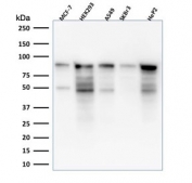 Western blot testing of human samples with microarray validated MCM7 antibody (clone MCM7/1469). Expected molecular weight: 80-90 kDa.