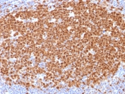 MCM7 Antibody Human Tonsil Tissue IHC. Immunohistochemistry testing of FFPE human tonsil with MCM7 antibody (clone MCM7/1468). Required HIER: boil tissue sections in pH 9 10mM Tris with 1mM EDTA for 10-20 min.