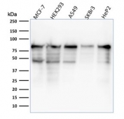 Western blot testing of human samples with HuProt Validated MCM7 antibody (clone MCM7/1468). Expected molecular weight: 80-90 kDa.