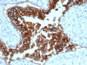 EpCAM Antibody Dog Bladder IHC. Immunohistochemistry staining of FFPE dog bladder tissue using EpCAM Antibody / Epithelial Cell Marker Antibody (clone EGP40/1372) demonstrates strong membranous HRP-DAB brown staining throughout the urothelial epithelial lining. The staining pattern is consistent with expression of Epithelial Cell Adhesion Molecule (EPCAM/CD326), a transmembrane glycoprotein involved in epithelial cell adhesion, maintenance of tissue architecture, and regulation of epithelial signaling pathways. Prominent circumferential membrane staining highlights cell-cell junctions within the urothelium and is characteristic of EpCAM expression in epithelial tissues. The observed immunoreactivity supports the use of EpCAM as a marker of epithelial lineage cells and epithelial-derived tissues across species. HIER: steam tissue sections in pH 9 EDTA buffer for 10-20 minutes prior to staining.