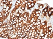 EpCAM Antibody Cat Small Intestine IHC. Immunohistochemistry staining of FFPE cat small intestine tissue using EpCAM Antibody / Epithelial Cell Marker Antibody (clone EGP40/1372) demonstrates strong membranous HRP-DAB brown staining throughout the intestinal epithelial lining, including absorptive enterocytes forming the glandular and villus-associated structures. The staining pattern is consistent with expression of Epithelial Cell Adhesion Molecule (EPCAM/CD326), a transmembrane glycoprotein that mediates epithelial cell adhesion and contributes to maintenance of epithelial architecture and tissue integrity. Prominent circumferential membrane staining highlights epithelial cell borders and is characteristic of EpCAM expression in gastrointestinal epithelial tissues. The observed immunoreactivity supports the use of EpCAM as a marker of epithelial lineage cells and epithelial-derived tissues across species. HIER: steam tissue sections in pH 9 EDTA buffer for 10-20 minutes prior to staining.