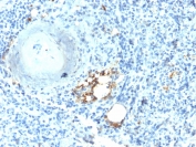IHC testing of FFPE human spleen with recombinant TRAcP antibody (clone ACP5/2336R).  Required HIER: boil tissue sections in 10mM citrate buffer, pH 6.0, for 10-20 min followed by cooling at RT for 20 min.
