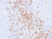 CD8A Antibody Tonsil IHC. Immunohistochemistry analysis of CD8 alpha (CD8A) in FFPE human tonsil tissue shows strong membranous staining of cytotoxic T lymphocytes within lymphoid regions, consistent with expected localization of CD8-positive T cells and supporting identification of immune cell populations in secondary lymphoid tissue. HuProt microarray validated antibody performance supports specificity-focused detection in complex immune-rich samples (clone rC8/468). Heat-induced epitope retrieval was performed in 10 mM citrate buffer, pH 6.0, for 10-20 minutes followed by cooling at room temperature.