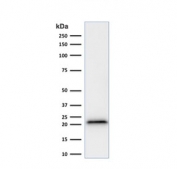 p21 Antibody Human HeLa WB. Western blot testing of human HeLa cell lysate with recombinant p21 antibody (clone rCIP1/823).