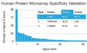 Thrombomodulin Antibody / Endothelial Cell Marker. Specificity validation of clone rTHBD/1591 using a HuProt(TM) human protein microarray containing more than 19,000 full-length human proteins. The antibody demonstrates strong selective binding to Thrombomodulin / THBD with the highest signal intensity among all proteins on the array, supporting the target specificity of the rTHBD/1591 monoclonal antibody.<BR>Z- and S-score interpretation: The Z-score represents the strength of the fluorescent signal generated when the antibody binds a specific protein on the HuProt(TM) array and is expressed as the number of standard deviations above the mean signal of all proteins on the array. Proteins are ranked based on descending Z-scores. The S-score represents the difference between consecutive Z-scores and therefore reflects the relative specificity of the antibody for its intended target compared with other proteins on the array.