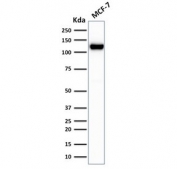 Western blot testing of human MCF-7 cell lysate with recombinant E-Cadherin antibody (clone rCDH1/1525). Expected molecular weight: 135 kDa (precursor), 80-120 kDa (mature, depending on glycosylation level).