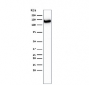 Western blot testing of human MCF-7 cell lysate with recombinant E-Cadherin antibody (clone CDH1/2208R). Expected molecular weight: 135 kDa (precursor), 80-120 kDa (mature, depending on glycosylation level).