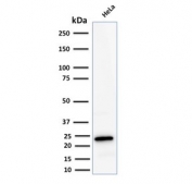 Ferritin Light Chain Antibody for WB HeLa. Western blot testing of human HeLa lysate with Ferritin Light Chain antibody. Predicted molecular weight: ~20 kDa.