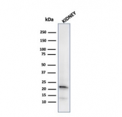 Ferritin Light Chain Antibody for WB Kidney. Western blot testing of human kidney lysate with Ferritin Light Chain antibody. Predicted molecular weight: ~20 kDa.