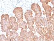 EpCAM Antibody Skin IHC. Immunohistochemistry testing of FFPE human skin with recombinant EpCAM antibody (clone rEGP40/1372). Required HIER: boil tissue sections in 10mM citrate buffer, pH 6, for 10-20 min followed by cooling at RT for 20 min.