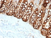 EpCAM Antibody FFPE Cat Small Intestine Tissue IHC. Immunohistochemistry staining of FFPE cat small intestine with recombinant EpCAM antibody (clone rEGP40/1372). HIER: boil tissue sections in pH 9 10mM Tris with 1mM EDTA for 20 min and allow to cool before testing.