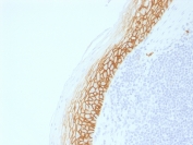 CD44v9 Antibody for IHC Tonsil. Immunohistochemistry analysis of CD44 variant 9 / CD44 expression in FFPE human tonsil using recombinant CD44v9 antibody (clone CD44v9/2344R). Prominent membranous HRP-DAB brown staining is observed along the epithelial layer, with sharp contrast to the underlying lymphoid compartment, highlighting cell surface localization consistent with CD44v9-mediated adhesion at epithelial-immune interfaces. The staining pattern emphasizes boundary organization between epithelial structures and lymphoid tissue, supporting its role in lymphoid activation and tissue architecture within tonsillar immune microenvironments. Heat induced epitope retrieval was performed by boiling tissue sections in pH 9 10mM Tris with 1mM EDTA for 10-20 min followed by cooling at RT for 20 min.