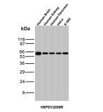 Recombinant HSP60 Antibody HSPD1/2206R in Human Tissues and Cancer Cell Lines WB. Western blot testing of human brain, kidney and pancreas tissue lysates and HeLa cervical cancer and K-562 myelogenous leukemia cell lysates with Recombinant HSP60 Antibody clone HSPD1/2206R shows a strong, specific band at approximately 60 kDa across all samples. The observed band is consistent with the expected molecular weight of HSPD1 and demonstrates robust HSP60 detection across the tested human tissues and cell lines.