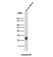 CD52 Antibody Spleen WB. Western blot analysis of CD52 / Campath-1 antigen expression in human spleen tissue lysate using CD52 antibody, clone CD52/2276R. Lane 1: human spleen tissue lysate. A band is detected at approximately 25 kDa, consistent with the predicted molecular weight of CD52, a glycosylphosphatidylinositol-anchored lymphocyte surface protein that can show migration shifts due to glycosylation.