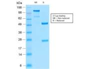 SDS-PAGE analysis of purified, BSA-free recombinant Insulin Receptor alpha antibody (clone INSR/2277R) as confirmation of integrity and purity.