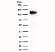 Western blot testing of human kidney lysate with Cadherin 16 antibody (clone rCDH16/1071).
