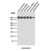 Cadherin 16 Antibody Multi-Species Kidney WB. Western blot analysis of Cadherin-16 / CDH16 expression across multi-species kidney tissue lysates using Cadherin 16 antibody clone rCDH16/1071. Lane 1: human kidney lysate, Lane 2: mouse kidney lysate, Lane 3: rat kidney lysate, Lane 4: hamster kidney lysate, Lane 5: guinea pig kidney lysate, Lane 6: rabbit kidney lysate. A band is detected at approximately 105-120 kDa, consistent with the predicted molecular weight of Cadherin-16 (CDH16), with the slightly higher apparent migration reflecting glycosylation of this kidney-restricted adhesion protein. The consistent signal across species supports the use of this clone for multi-species kidney reactivity studies and reflects conserved Cadherin-16 expression in renal epithelial tissue.