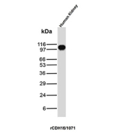 Cadherin 16 Antibody Kidney Tissue WB. Western blot analysis of Cadherin-16 / CDH16 expression in human kidney tissue lysate using Cadherin 16 antibody clone rCDH16/1071. Lane 1: human kidney lysate. A band is detected at approximately 100â110 kDa, consistent with the predicted molecular weight of Cadherin-16 (CDH16), with the slightly higher apparent migration reflecting glycosylation of this kidney-restricted adhesion protein. The strong signal in kidney tissue supports the use of this antibody for detecting CDH16 in renal epithelial cells and aligns with its role as a conserved kidney-specific marker.