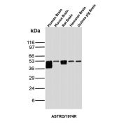 GFAP Antibody Brain Tissue WB. Western blot analysis of human brain, mouse brain, rat brain, hamster brain, and guinea pig brain tissue lysates using recombinant GFAP Antibody clone ASTRO/1974R. Strong bands are detected at approximately 50 kDa across multiple mammalian brain samples, consistent with the predicted molecular weight of Glial fibrillary acidic protein / GFAP, a major astrocytic intermediate filament protein involved in maintenance of neural cytoskeletal architecture and central nervous system integrity. Subtle lower molecular weight signal broadening beneath the primary human brain band likely reflects GFAP isoforms and/or partial proteolytic processing products commonly observed in neural tissue extracts.