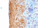 Involucrin Antibody IVRN/2113R in Human Tonsil IHC. Immunohistochemistry testing of FFPE human tonsil tissue with Involucrin Antibody clone IVRN/2113R. Staining of formalin-fixed tissue is enhanced by digestion with Trypsin or Protease XXV at 1 mg/ml PBS for 5 min at 37oC, which is more effective than citrate buffer-based epitope unmasking for this antibody. Strong brown cytoplasmic staining is concentrated throughout the differentiated suprabasal squamous epithelium, while the adjacent lymphoid tissue shows comparatively little signal. This differentiation-associated epithelial pattern demonstrates detection of involucrin using the IVL Monoclonal Antibody.