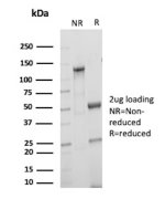Purified Involucrin Antibody IVRN/2113R SDS-PAGE. SDS-PAGE analysis of purified, BSA-free Involucrin Antibody clone IVRN/2113R under non-reducing and reducing conditions. The non-reduced preparation shows the intact antibody at approximately 150 kDa, while reduction produces the expected immunoglobulin heavy and light chains at approximately 50 kDa and 25 kDa. The expected electrophoretic profile provides a quality-control assessment of the purified recombinant rabbit IVL Monoclonal Antibody.