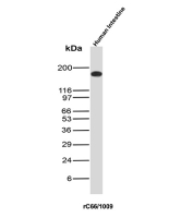 CEA Antibody Intestine WB. Western blot analysis of CEA / CEACAM5 expression in human intestine tissue lysate using recombinant CEA antibody, clone rC66/1009. Lane 1: human intestine tissue lysate. A strong band is detected at approximately 180-200 kDa, consistent with the predicted molecular weight of CEACAM5, with the elevated apparent size reflecting extensive glycosylation typical of this epithelial cell surface glycoprotein.